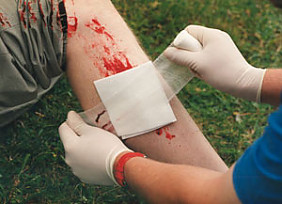Verband anlegen an einem blutenden Bein