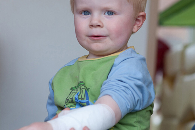 Kleinkind mit verbundenem Arm